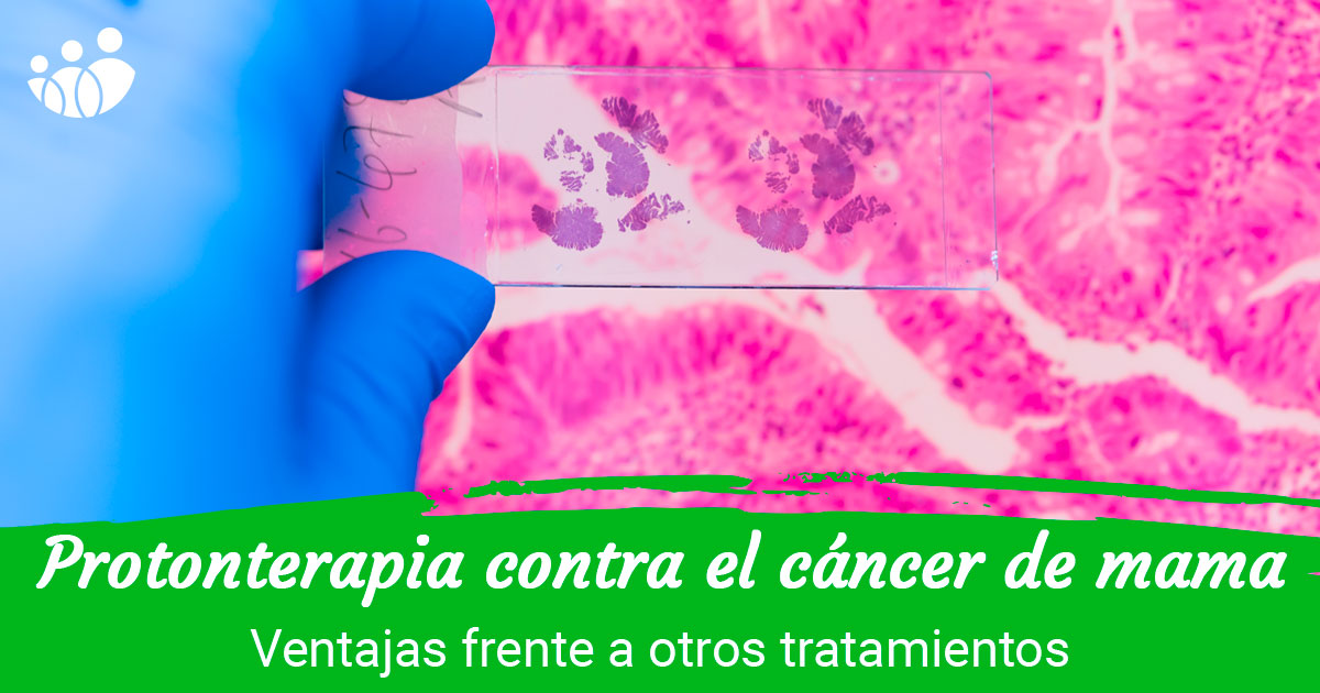 La protonterapia contra el cáncer de mama reduce la exposición de la