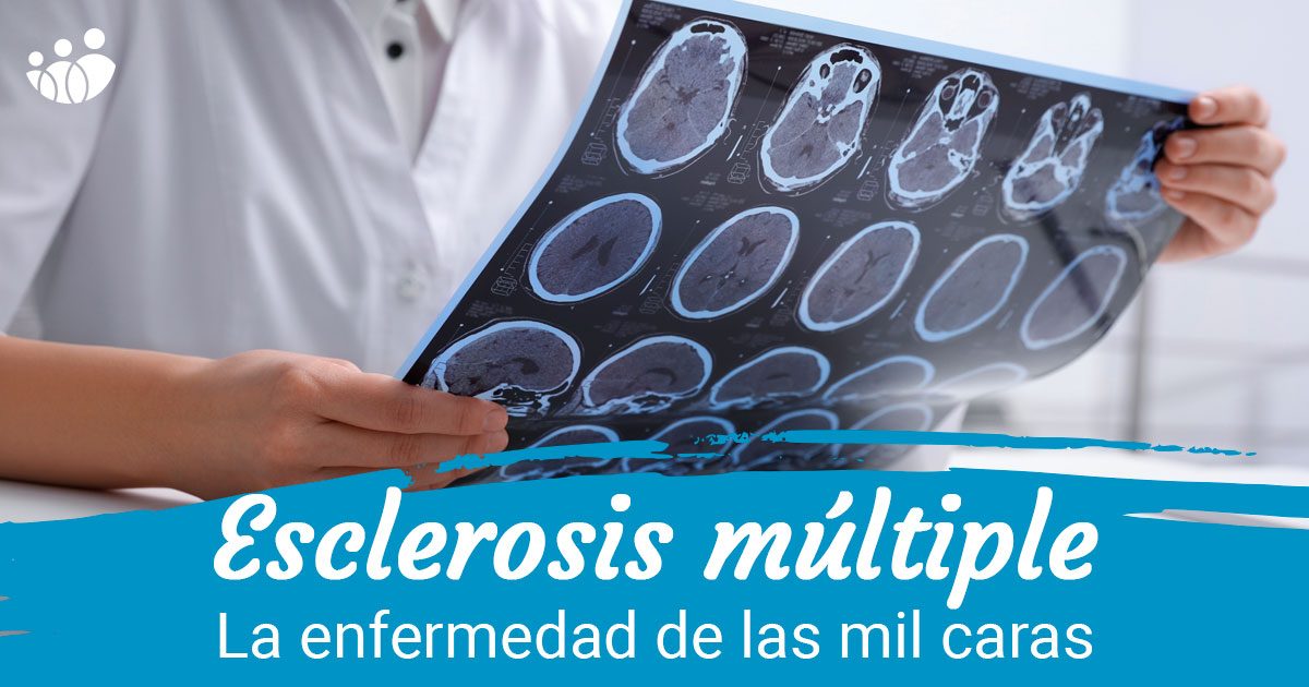 Esclerosis múltiple: la enfermedad de las mil caras - Noticias Acunsa