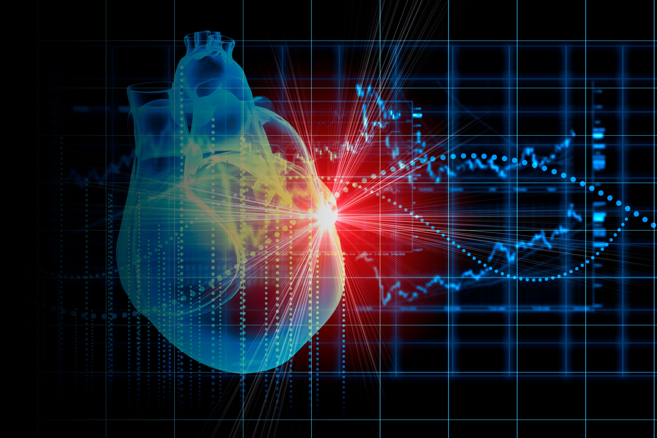 amiloidosis-cardiaca-estudio-cima-filtro - Noticias Acunsa